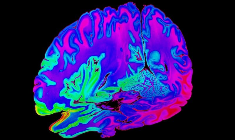 3D Slices - DICOM Vision