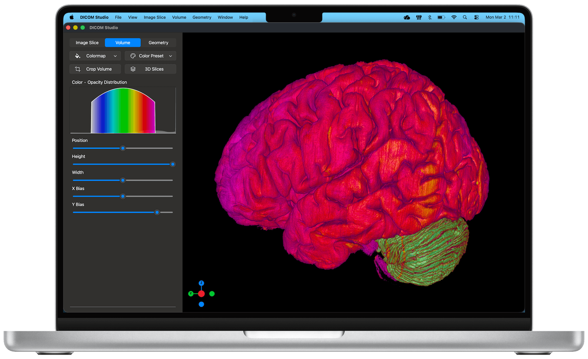DICOM Vision on Mac