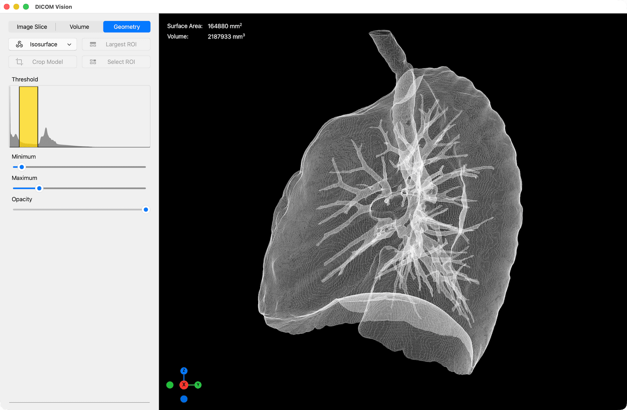 Isosurface Wireframe - DICOM Vision
