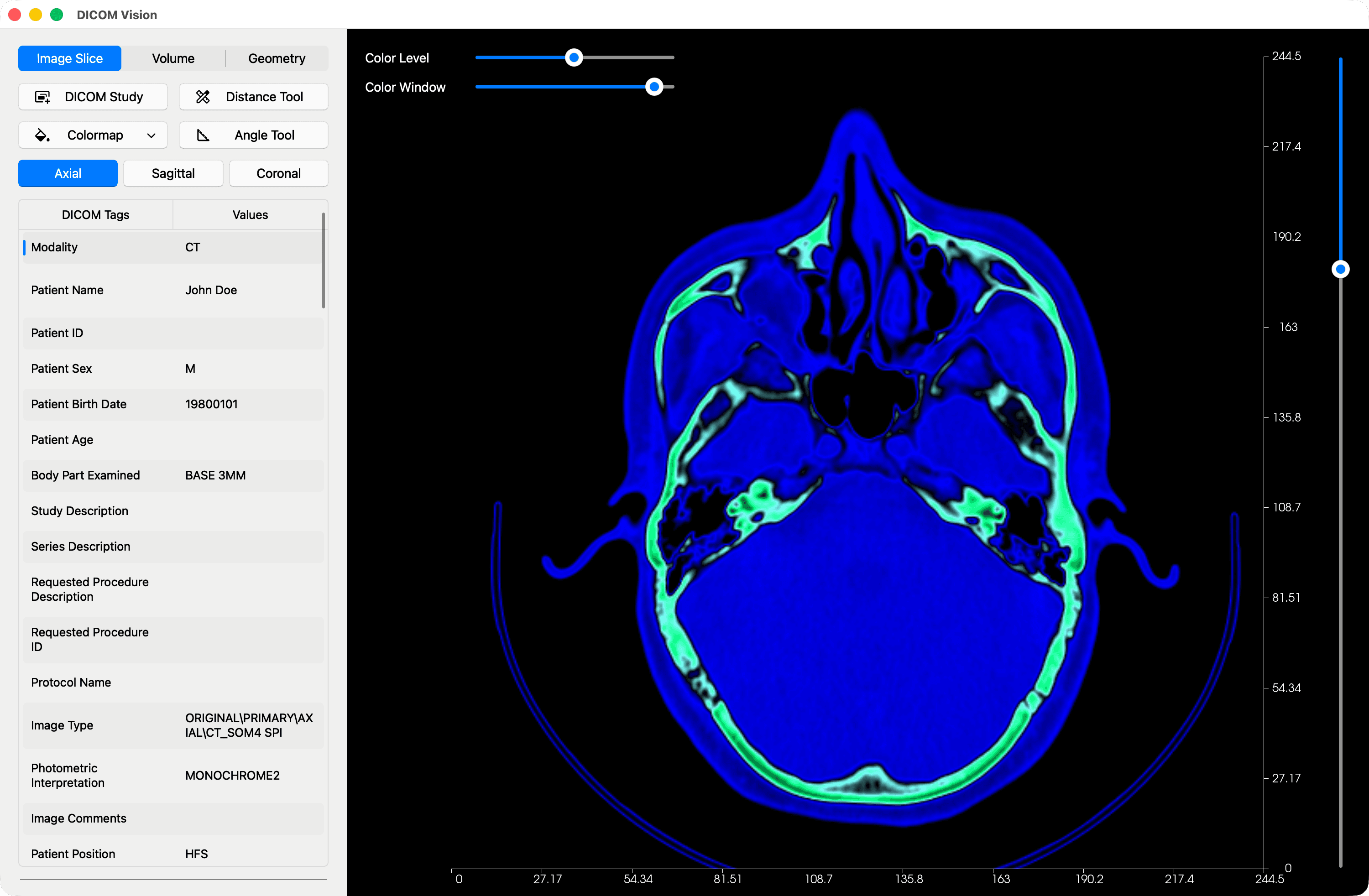 Colormap Applied to DICOM Slice - DICOM Vision