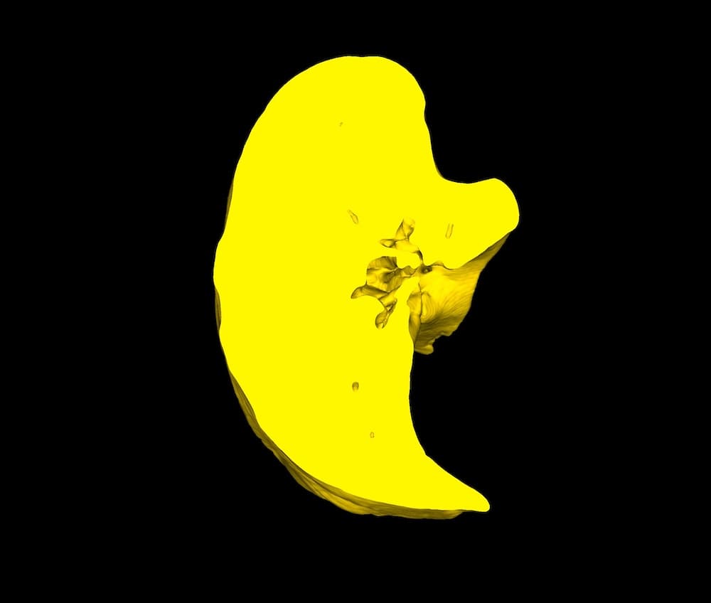 Crop with Closed Edges - DICOM Vision