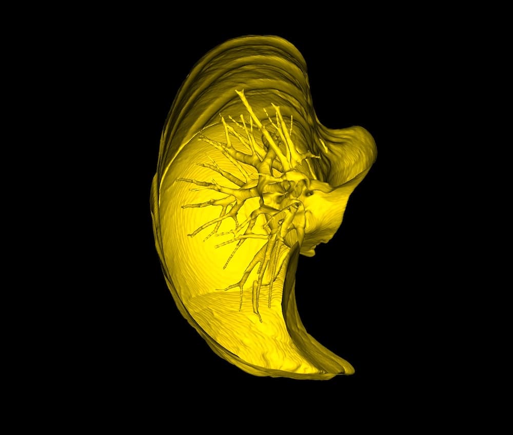 Crop with Open Edges - DICOM Vision