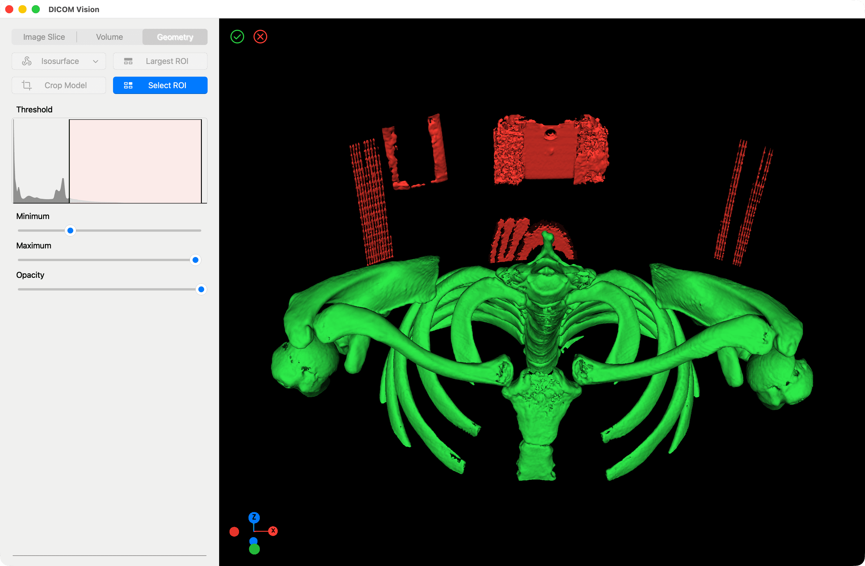 Select Region of Interest - DICOM Vision