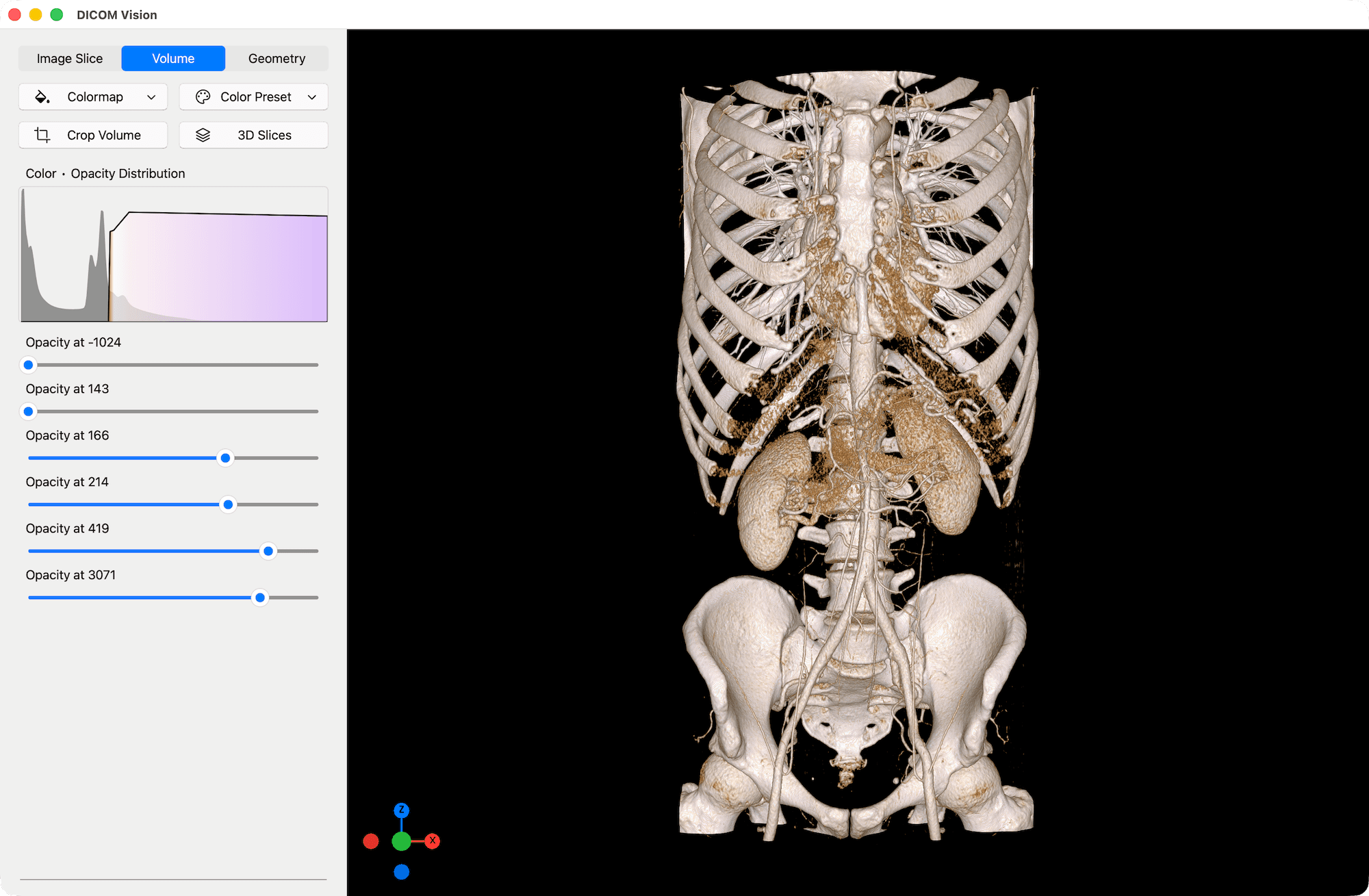 Volume Color Preset - DICOM Vision