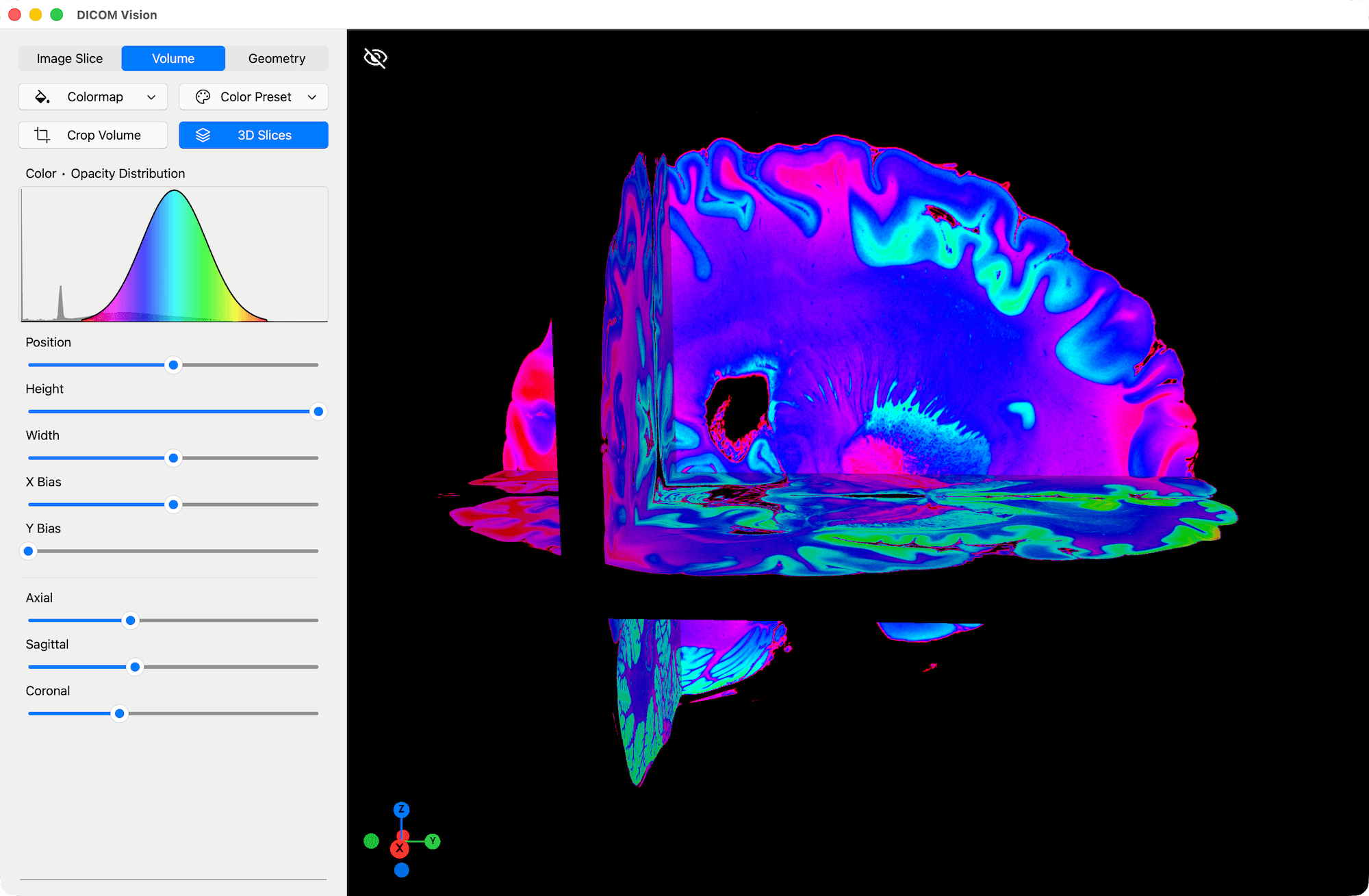 3D Slices - DICOM Vision