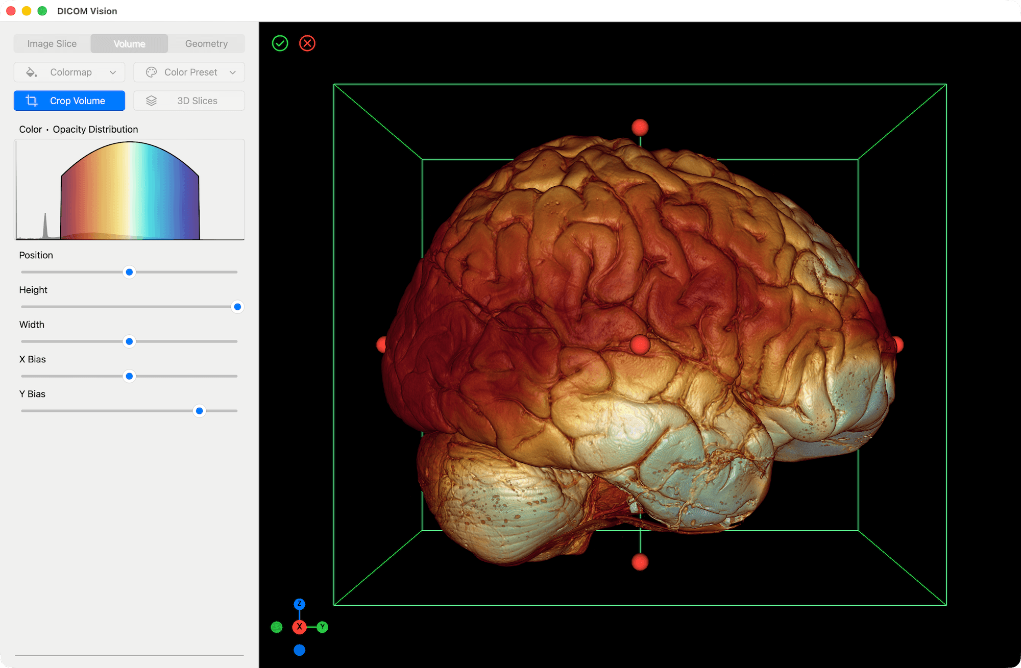 Volume Crop Before - DICOM Vision